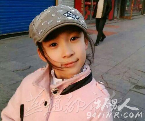 我想救姥姥 9岁女孩高子涵为救姥姥冲入火海重度烧伤(组图)