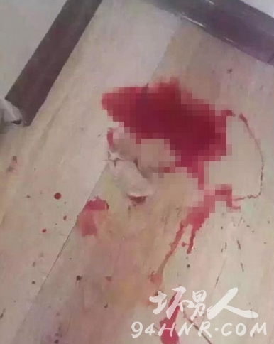 长春虐狗事件始末|最新消息 砍狗人个人资料遭人肉 微信雪纳瑞拉瑞麻麻真实身份曝光