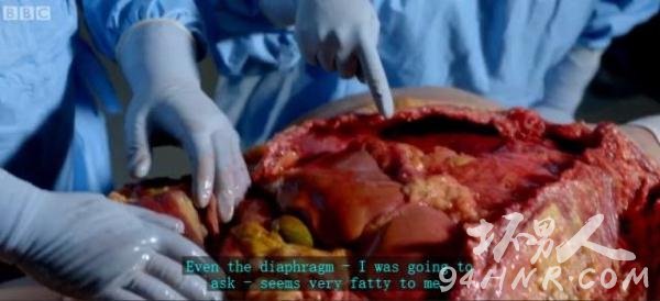 The Post Mortem截图