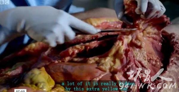 The Post Mortem截图