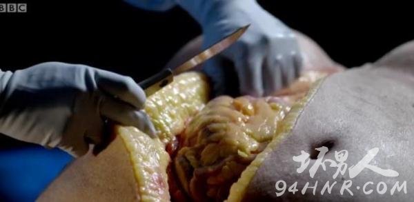 The Post Mortem截图