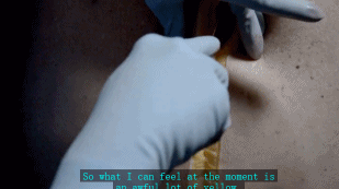 尸体解剖现场图片