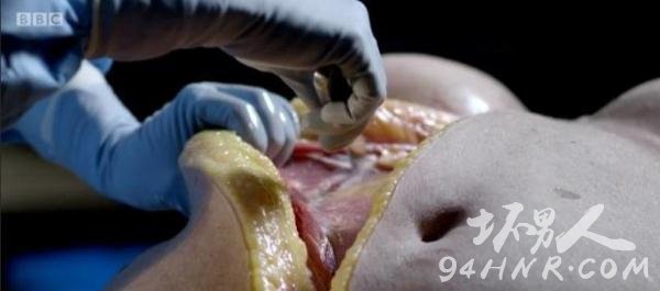 尸体解剖现场图片