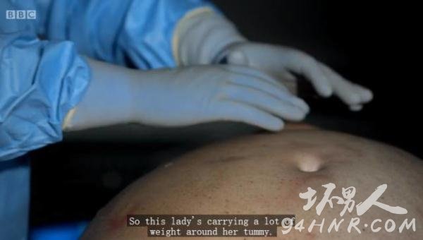 尸体解剖现场图片