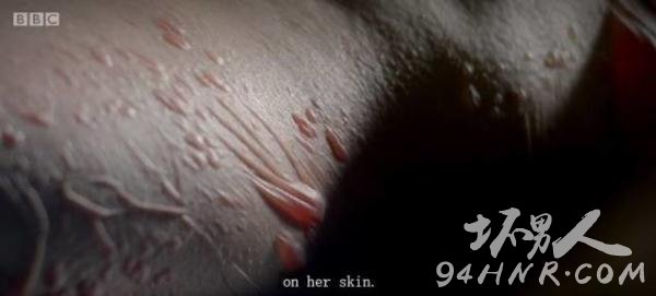 尸体解剖现场图片