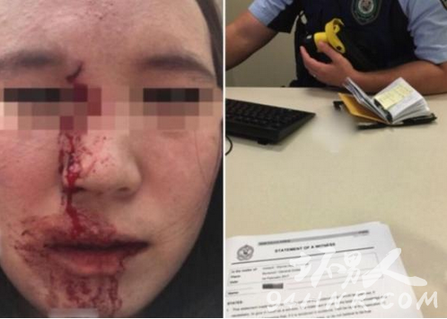 華人女子被澳男子辱罵毆打 大喊“滾出我的國家”