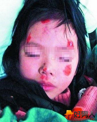 父亲虐打女童后被碾死
