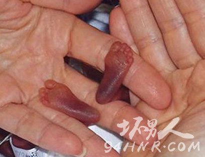 世界上最小的婴儿