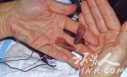 世界上最小的婴儿