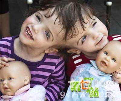 7岁连体姐妹共用双腿 揭秘连体人日常生活(7)_图1
