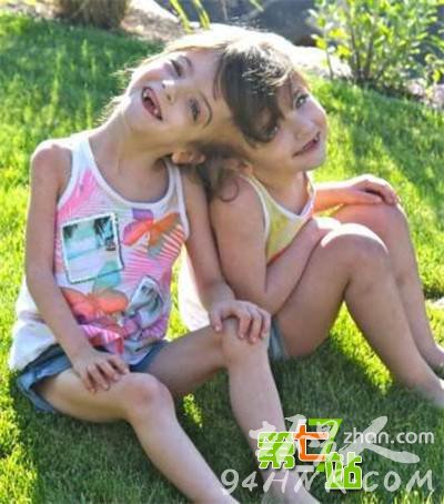 7岁连体姐妹共用双腿 揭秘连体人日常生活(8)_图1