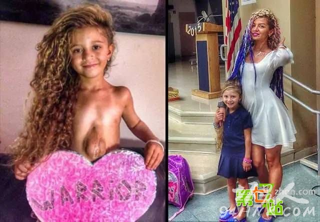 6岁女孩脱光上衣后 所有人都惊呆了