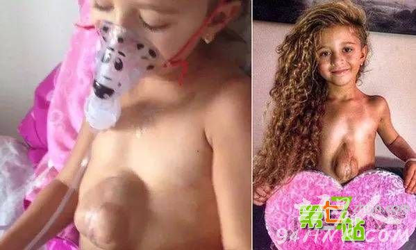 6岁女孩脱光上衣后 所有人都惊呆了